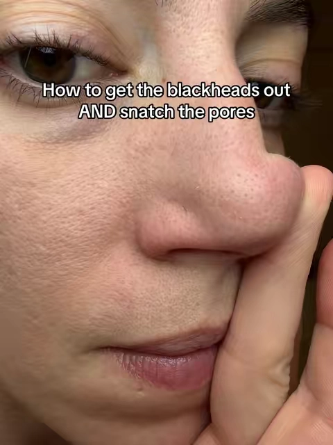 Dr melaxin cactox nose pore strips got all the nasty gunk out of my pores and left my pores looking so clean and small! #drmelaxin #blackhead #cleanpores 