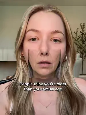 This is the reason why people get tox, but most people don't know this one thing #skincare #drmelaxin #koreanskincare #dealsforyoudays 