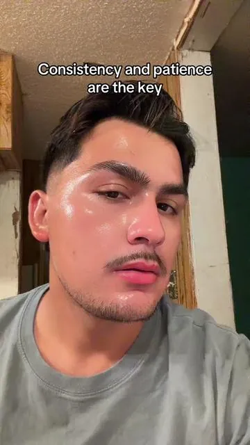 #creatorsearchinsights #acnescars #darkspots #vitaminc #viralvideo 