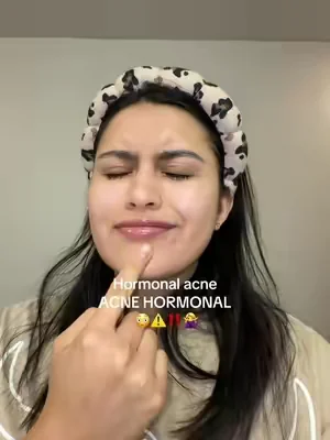 Gracias a la chica que me recomendó estos pads! 🤎✨ #medicubepads #medicubeskincare #hormonalacne #acnehormonal #sensitiveskincareroutineproducts 
