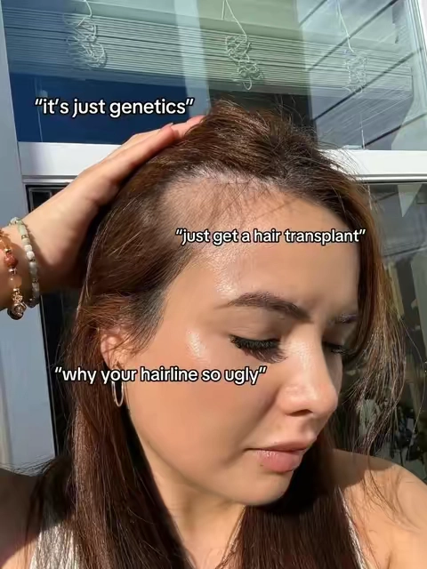 post partum hair loss aint got nothing on me