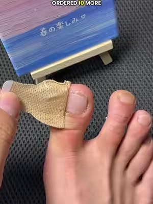 You won’t believe what one week of using this patch did to my feet!✨#nailfungus #nailrepair #uglynail #yellownails #DealsforYouDays