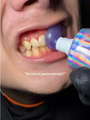 Sera que sirve? #teethwhitening #dientesblancos #dealsforyoudays #tiktokshopcreatorpicks #summerfinds @MySmile 