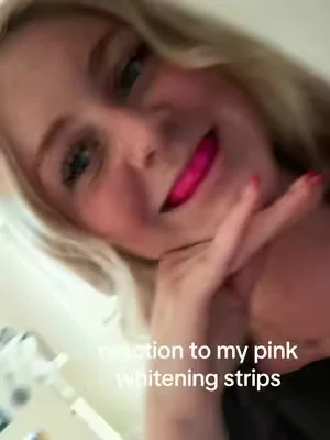 “Why do you have pink teeth”