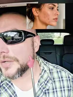 #hormonalacne #acnesupport #adultacne #clearskinjourney #skinfromwithin      Results may vary, this is not medical advice! Price may vary depending on price at time of viewing and coupons available.