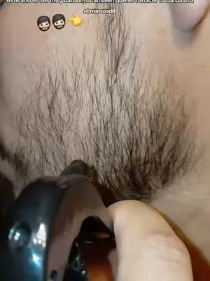 #creatorsearchinsights #beardgrow #minoxidil #paratiiii 