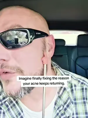 #hormonalacne #acnesupport #adultacne #clearskinjourney #skinfromwithin      Results may vary, this is not medical advice! Price may vary depending on price at time of viewing and coupons available.