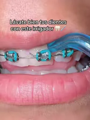 Gurunanda Kid's Water Flosser #gurunanda #irrigador #dientes #dienteslimpios #dealsforyoudays @GuruNanda LLC 