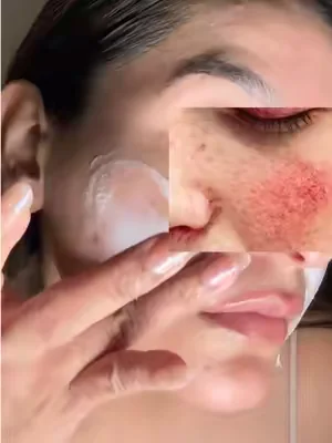 #pielsensible #kbeauty #DealsForYouDays #SummerWins 