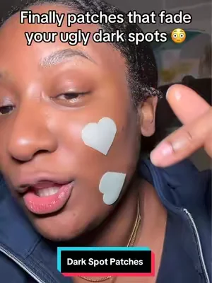 These are life saver for the dark spots and hyperpigmentation all over my face … #DarkSpot #glutathione #hyperpigmentation #summeressentials #dealsforyoudays 