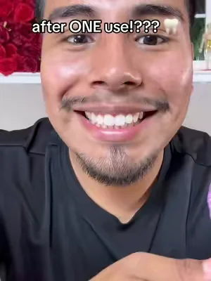 If you want white ass teeth you need to check these out 😭🦷 @SAKYPRORAL #teethwhitening #sakyproral #sakyproalwhiteningstrips 