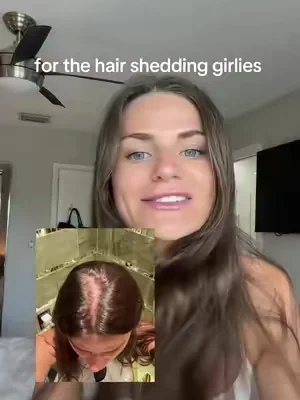 the BEST hair care for the shedding girlies 🫶