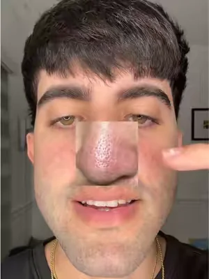 Los resultados me impresionaron #skincare#koreanskincare#jiyu#tonerpads#dealsforyoudays