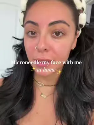 The depth and speeds below:  Forehead - .5 / Speed 2 Under eye - .25 / Speed 1 Cheeks, Jawline - 1.0 / Speed 3-4 Lips - .25 / Speed 1 #microneedling #diymicroneedling #athomemicroneeedling #microneedlingaftercare 