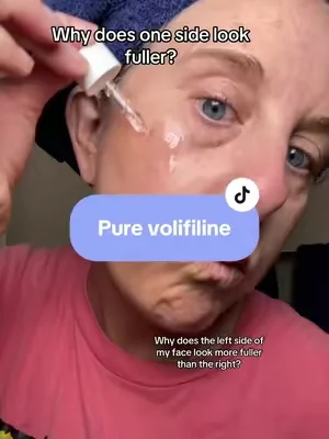 I really thought I was imagining it until I compared both sides of my face… 👀 I’ve been testing Pure Volufiline on just one side around my smile line and cheek area, and that side looks noticeably more hydrated and plump-looking to me #V#Volufilinet#tiktokmademebuyitv#viralbeautys#skincareroutinetiktokshopcreatorpicks