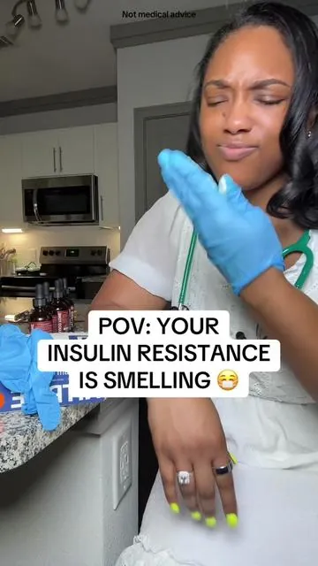 PREVENTION STARTS NOW! Your beauty shouldn’t get stolen by dysregulated sugars and insulin.  Get your insulin and sugars in check! As always, discuss all health concerns/supplements with your doctor.  If you’re ready, grab this TikTok Shop deal before it's gone!  #tiktokshopcreatorpicks #bloodsugar #dealsforyoudays #tiktokshopsummerturnup #summerwins  30+ women free shipping womens supplements 35+ women coupon code 35+ females Female supplements Female health 35+ women beauty women 35+ beauty female beauty female 35+ beauty, TikTok deal, TikTok deals, TikTok flash sale, TikTok Shop Finds, SAHMs of TikTok, TikTok Shop Deals, TikTok Shop Deal, Code, Coupon, Deal, Flash Sale, Discount, TikTok Shop, TikTok Deals, Clean Nutra BOGO Organic Ceylon Cinnamon, Berberine, Bitter Melon, Glucomannan, Chromium, Turmeric, Organic Panax Ginseng, for Clean Fitness and Blood Sugar Supplement Liquid Drops - Gluco Tone, Enhance your wellness routine with Clean Nutra's Organic Ceylon Cinnamon Berberine Liquid Drops Supplement. This vegetarian formula is packed with beneficial ingredients to help support your overall health. • Organic Ingredients • Featuring a blend of organic Ceylon cinnamon, berberine, bitter melon extract, glucomannan, gymnema, chromium, turmeric • Premium Additions • Including organic apple cider vinegar and moringa powder  • Made in the US by Clean Nutraceuticals This supplement offers a convenient liquid form to help with absorption and is suitable for individuals looking to incorporate natural ingredients into their diet. Please note the age warning associated with this product. **The above statements and anything stated in this video have not been evaluated by the Food and Drug Administration nor are these statements medical advice. As with any supplement, individual results and responses may vary due to differences in age, weight, body chemistry, lifestyle, consistency of use, overall health, preexisting health conditions and possible interactions with medications. This product is not intended to diagnose, treat, or cure any disease.** Sales and Shipping may change at any time after this video was posted, at the discretion of the brand. Tap the product link on this post for the most current price. Final price may vary depending on each customer’s available coupons. Items and quantities in your cart are exactly what you will receive unless the brand’s product page or the deals tab at checkout explicitly mentions an offer giving you additional items with your purchase.  As an affiliate, I may earn a commission from sales through this video. 