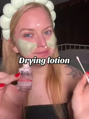 I know that they’re gonna keep coming, so that’s why I say stocked up on this drying lotion from medicube 🙌🏻👏🏻 #acne #hormonalacne #medicube 