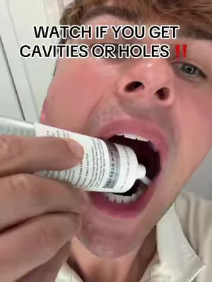 #boka #toothpaste #dentist #teeth #cavities 