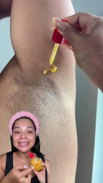 Sigues intentando mejorar la hiperpigmentacion en partes de tu cuerpo, entonces prueba este dúo de vitamina C 💛💛. Te dejo el link aquí arriba 👆🏻⬆️ .  . . . . . #eqqualberry #vitaminserum #darkspots #acnescars #hyperpigmentation  