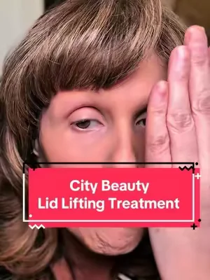 #creatorsearchinsights Hooded eyes? Drooping lids? Meet your new best friend 🤩✨ The @CityBeauty Lid Lifting Treatment literally smooths and tightens your eye area so your makeup actually sits right! #dealsforyoudays #hoodedeyes #maturebeauty #antiagingtips 