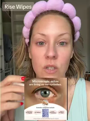 @CorneaCare #corneacare #hygeine #personalhygiene #itchyeye #dryeyes 