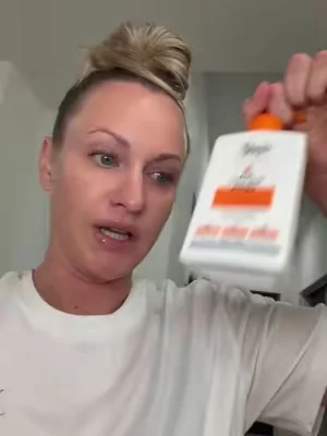 Replying to @Texas _Girll hs& acneit is not hygiene related btw  #hidradenitissuppurativaawareness #cysticacne #tiktokshopcreatorpicks #acneproneskin #boils 