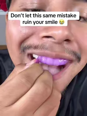 I wish I found these whitening strips sooner. 😭🦷 teeth whitening strips, hydrogen peroxide whitening strips, at home teeth whitening, remove surface stains, brighter smile #DealsForYouDays #sakyproral #sakyproralwhiteningstrips #teethwhitening @sakyproral_us 