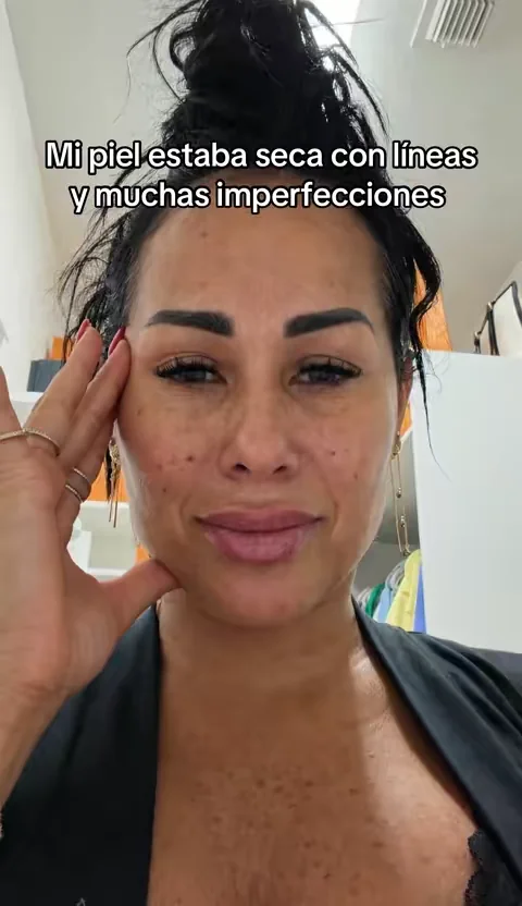 @anua_global siempre lo hace posible con su Skincare maravilloso  ✨ #KBeautyGlow 🩷 #GlassSkinRoutine 🌸 #AntiAgingSkincare 💎 #CollagenBoost 🛍️ #TikTokShopFinds   Disclaimer: los resultados pueden variar