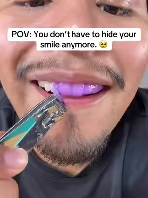 Finally found whitening strips that actually use hydrogen peroxide. 🦷✨ hydrogen peroxide teeth whitening, purple whitening strips, enamel safe whitening strips, at home teeth whitening, whitening strips for stained teeth #DealsForYouDays #sakyproral #sakyproralwhiteningstrips #teethwhitening @sakyproral_us 
