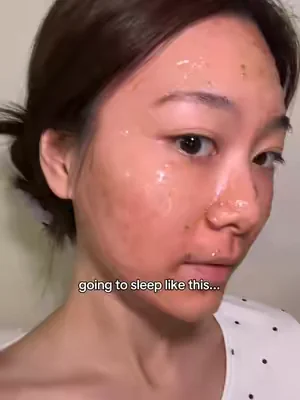 Going to sleep like this... so I can wake up like this. 😴✨ No more waking up to red, angry skin. #weeklydeals #summerwins #skinbarrierrepair #sensitiveskin #drleohonestreview 