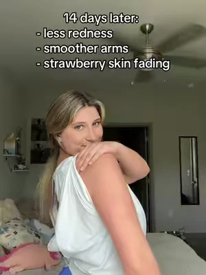 i can’t believe i found something working to clear my KP 🥲 #KP #skintransformation #strawberryskin 