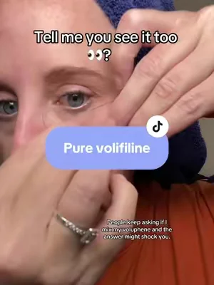 I’ve been testing Pure Volufiline on just one side around my smile line and cheek area, and that side looks noticeably more hydrated and plump-looking to me. #Volufiline #tiktokmademebuyit #viralbeauty #skincareroutine #tiktokshopcreatorpicks