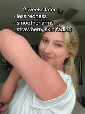 never thought i’d find something that actually helps 🥲 #KP #strawberryskin #skintransformation 