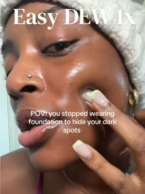 Darks spots be gonnnne #easydew #egf #ampoule #hyperpigmentation #DealsForYouDays 