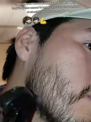 #paratiiiiii #minoxidil #beardgrowth #hairgrowth #tiktokshopcreatorpicks 