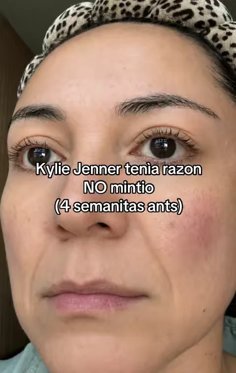 la verdad que me dan ganas de llorar no me la creo porque mi cara estaba muy deshidratada #colagenoparalasmujeres #arrugasfaciales #k2oglowthissummerchallenge #electrolytes #pielhidratada disclaimer: precios promocione y resultados pueden variar