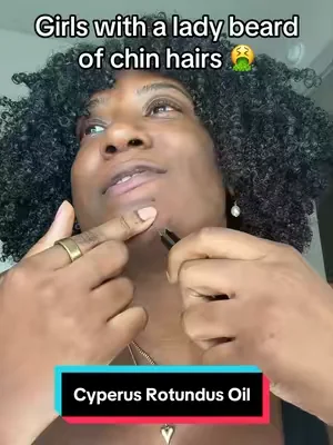 This oil is helping me getting rid of my biggest insecurity 🤯#chinhairs #cyperusrotundusoil #pcos #dealsforyoudays #summeressentials 