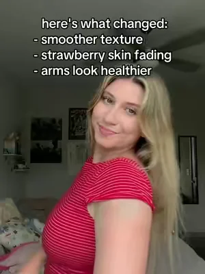 after years of hiding and avoiding tanks, i finally found something working to clear my KP 🥲 #KP #strawberryskin #skintransformation 