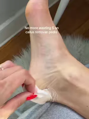 I was actually not expecting that after first use 🤯 #dryfeet #crackedheels #sheabutter #pedicure #tiktokshopcreatorpicks Results vary, Ad 