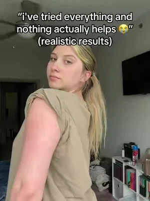 nothing thought i’d find something that works 🥲 #KP #strawberryskin #skintransformation 