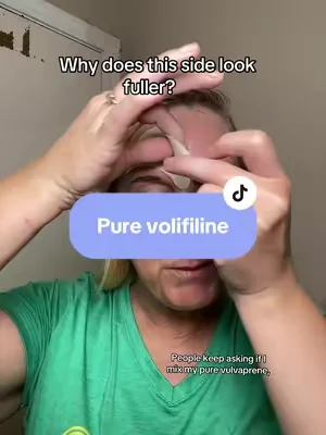 I really thought I was imagining it until I compared both sides of my face… 👀 I’ve been testing Pure Volufiline on just one side around my smile line and cheek area, and that side looks noticeably more hydrated and plump-looking to me. If you’ve been curious about trying it, I linked the exact one I’m using. #Volufiline #tiktokmademebuyit #viralbeauty #skincareroutine #tiktokshopcreatorpicks