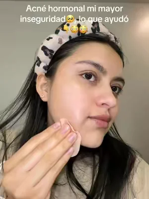 🤎los pads de medicube rojos lo mejor para el acné hormonal!  #medicubepads #medicubeskincare #hormonalacne #acnehormonal #medicubepartner  @medicube global 