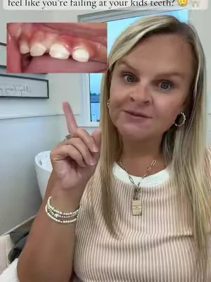 if you have ever left the dentist feeling defeated, this video is for you. enamel Hypoplasia had started on my kids front teeth and this toothpaste was a gamechanger for us. #nobsjr #cavities #toothpaste #MomsofTikTok 