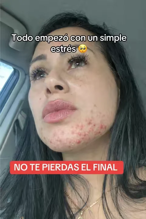 La mejor reco de mi fyp 👆🥺😍🙏🏻  #hairgrowth #hairserum #crecimientodelcabello #tiktokshopstockup #MomsofTikTok  Disclaimer: los resultados pueden variar hablo desde mi experiencia en mi video no hay afirmaciones médicas. 
