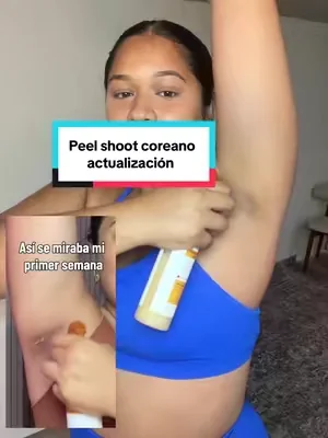 @Dr Melaxin® esta es mi semana cuatro utilizando doctor Melaxin no puedo estar más feliz con los resultados, literalmente cada que lo utilizo veo la diferencia y amo ya no me siento insegura si tú estás pasando por lo mismo déjame decirte que no estás sola somos muchas chicas que pasamos por esto y que es una maravilla saber que hay productos que funcionan súper bien #drmelaxin #peelshoot #semana4 #4taparte #update 