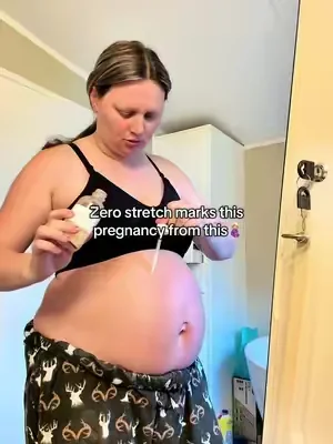 Stretch mark serum and nourishing overnight balm has helped so much during this pregnancy! #stretchmarks #pregnancy #stretchmarkcream #stretchmarkprevention 
