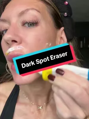 My skin is so bright and glowy @Dr.Melaxin #dealsforyoudays 