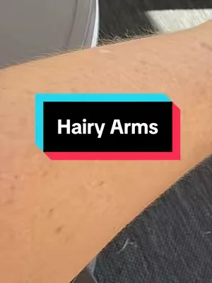 Hairy arms 😳 #dealsforyoudays #perimenopause 