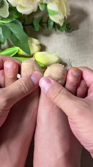 You won’t believe what one week of using this patch did to my feet!✨#nailfungus #nailrepair #uglynail #yellownails #DealsforYouDays