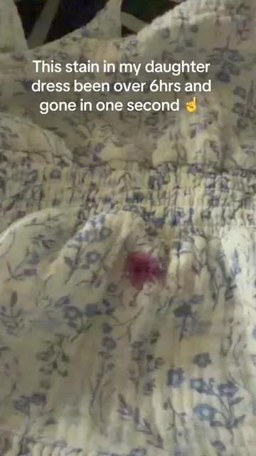 If you have kids you need to get this stain removal 